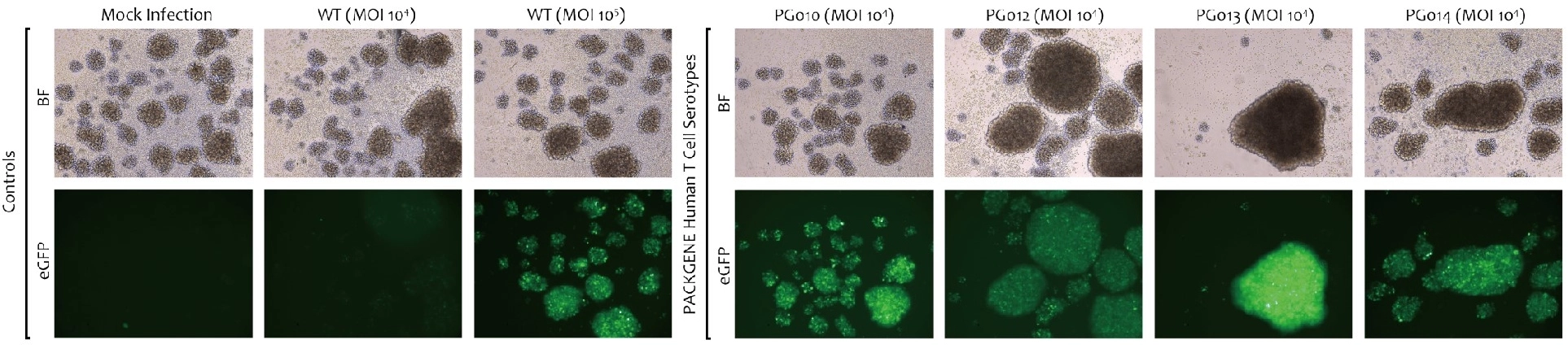 Infection-of-Quiescent-Primary-Human-T-Cells-with-Novel-PackGene-AAV6-Serotypes-Imaging1